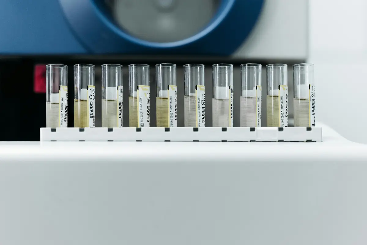 Analito - Tubos de ensaio em laboratório